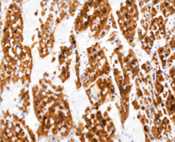 IHC 免疫组化切片