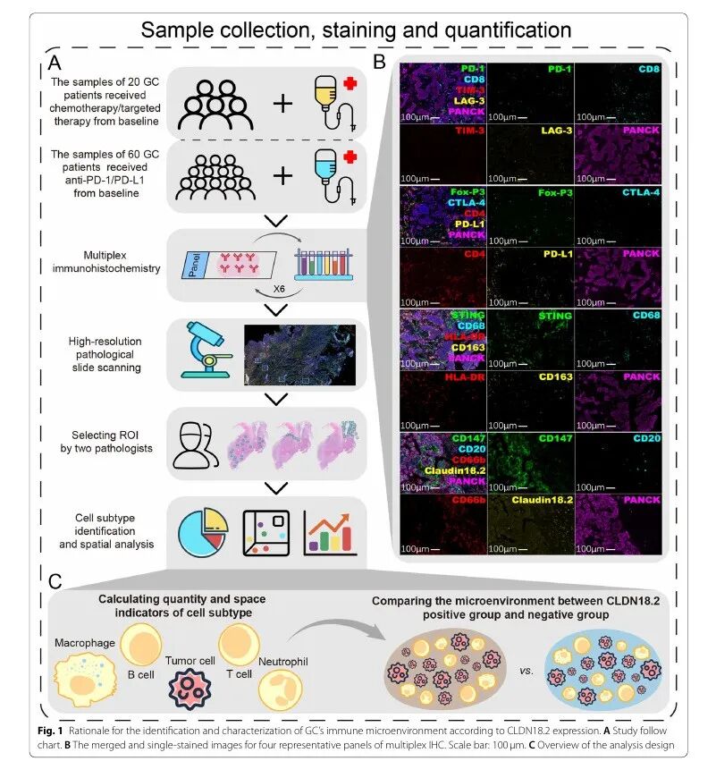 胃癌 CLDN18.2 研究,20 μm 邻近分析是怎么算的?